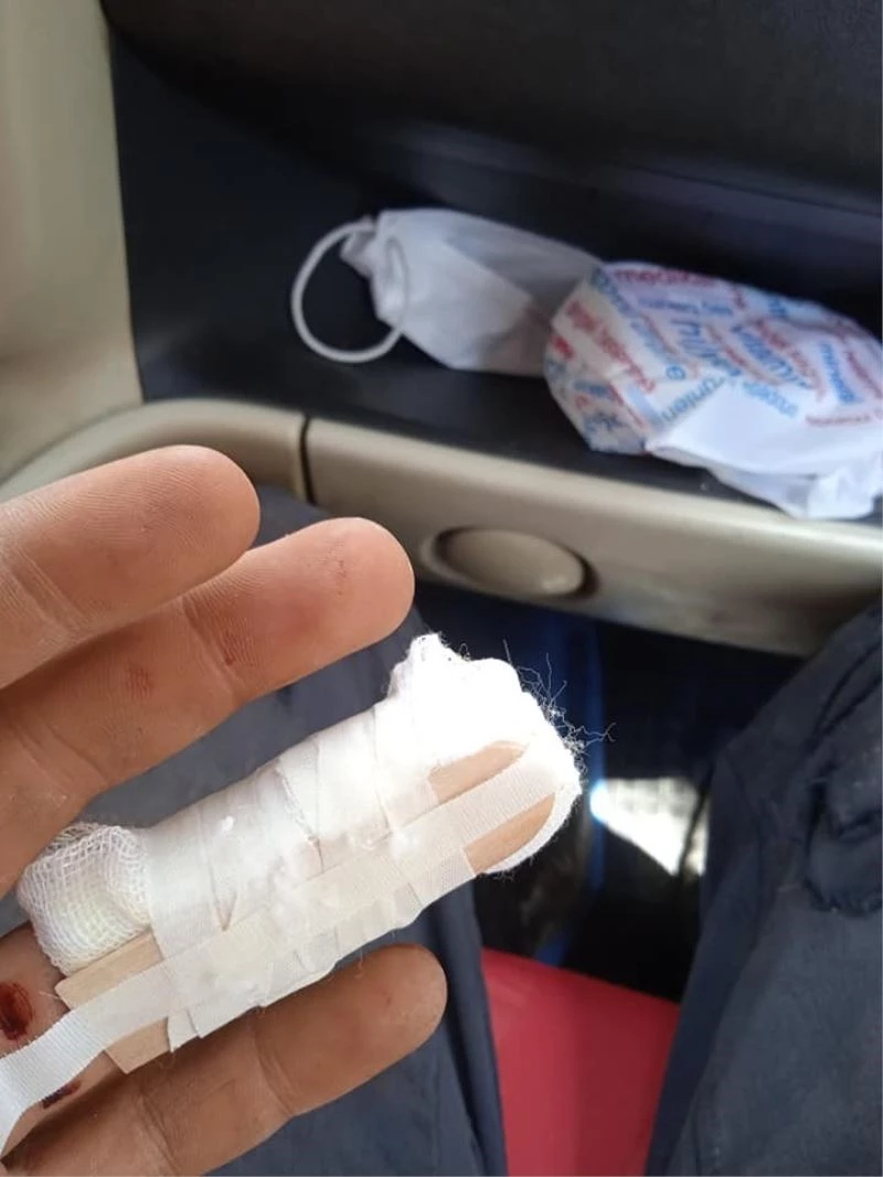 Parmağındaki 3 santimetrelik vidayla hastaneye koştu
