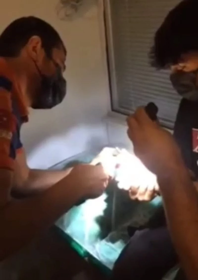 AFAD ekipleri, parmakta sıkışan yüzüğü çıkarttı
