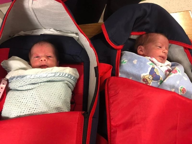 Suriyeli ikizler Türkiye’de şifa buldu
