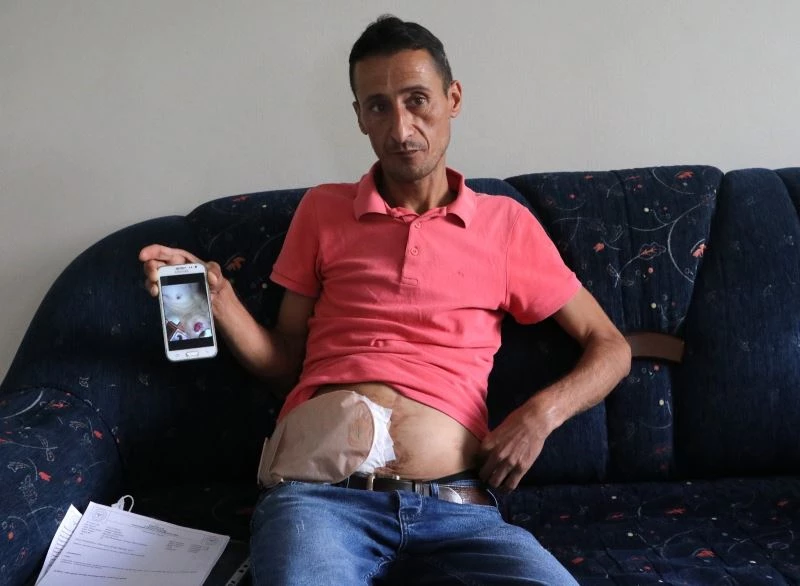 Bağırsakları vücudunun dışında olan adam yardım bekliyor
