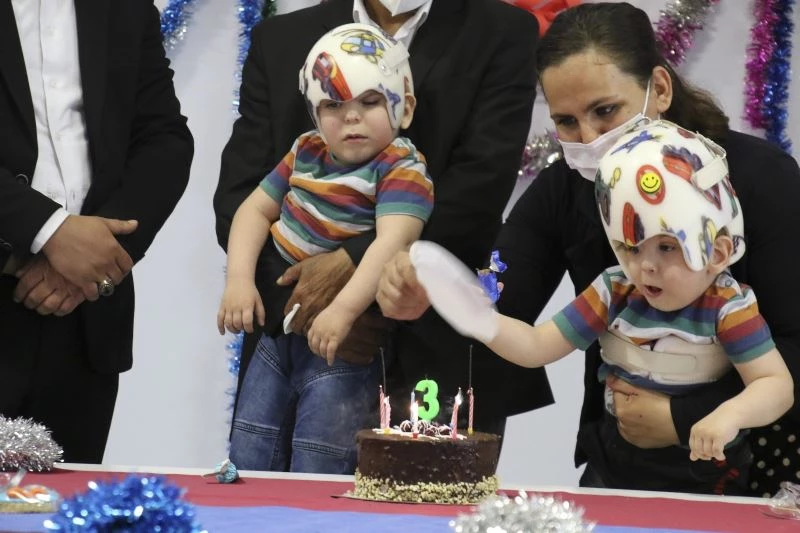 Ameliyatla ayrılan siyam ikizlerine doğum günü sürprizi
