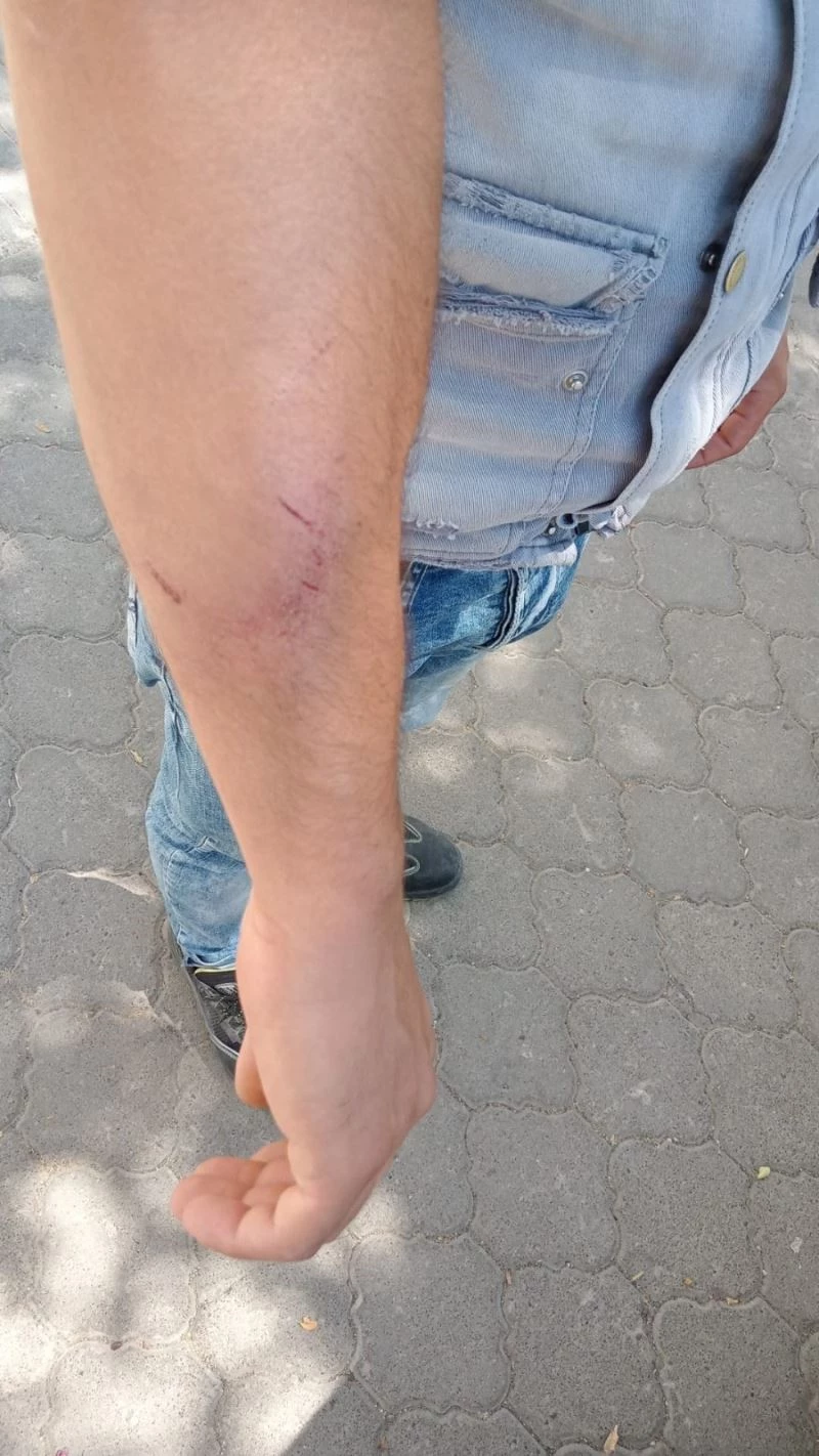 Akedaş elektrik dağıtım personeline saldırı
