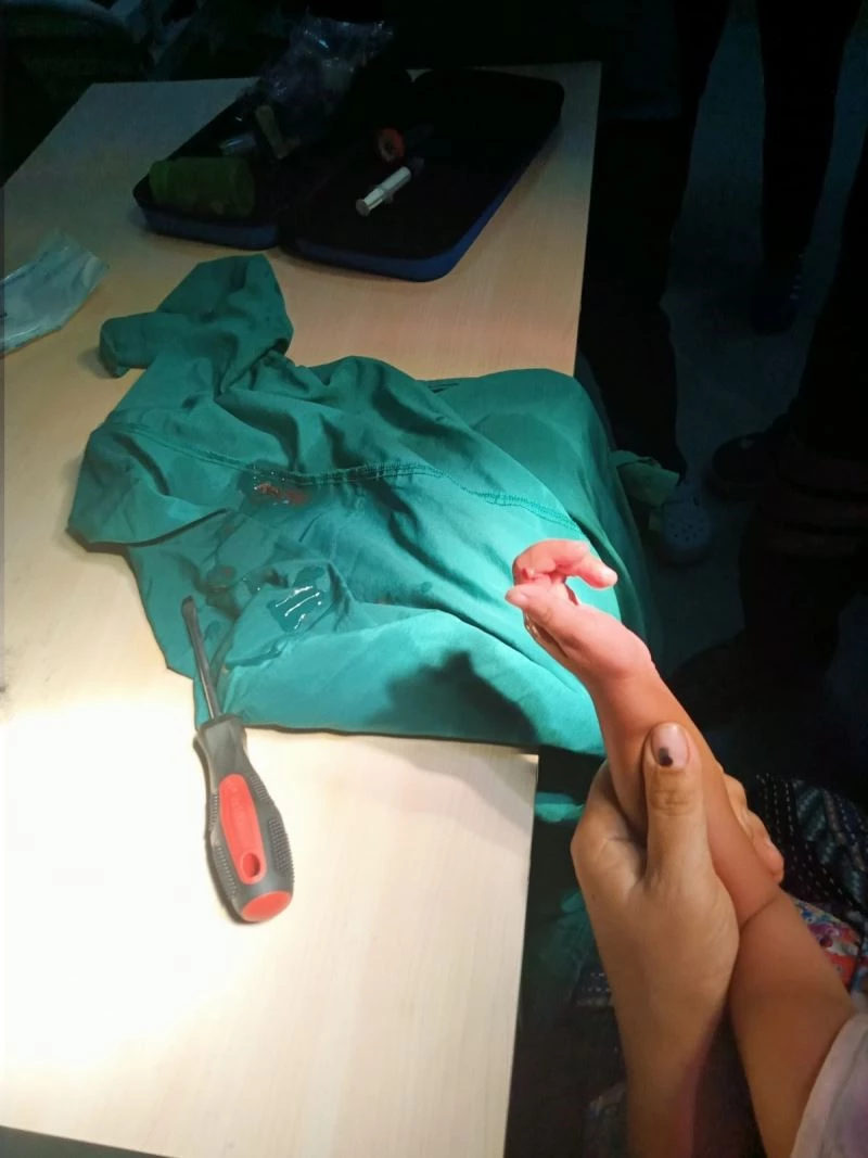 Parmağı korkuluğa sıkışan çocuğu AFAD ve itfaiye ekipleri kurtardı
