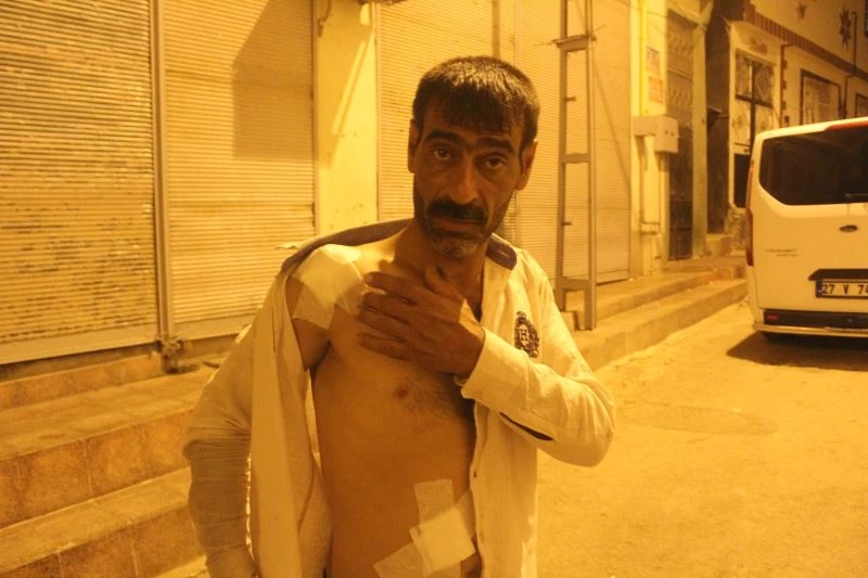 Damda çay içerken kavgada ateşlenen saçmaların hedefi oldu
