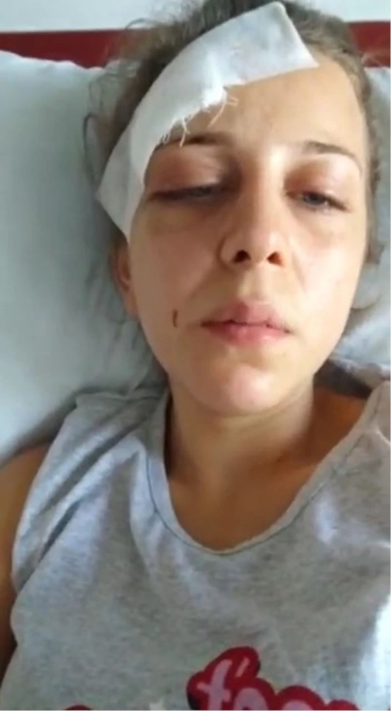 Eski eşinden saatler boyunca gördüğü işkenceyi böyle anlattı:
