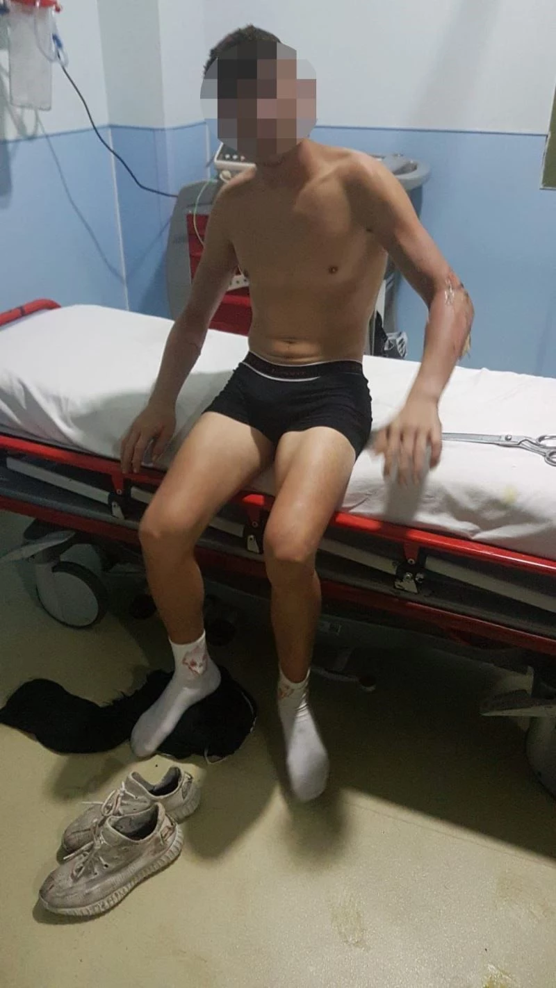 Arnavutköy’de konteynerde oturan çocuklar çakmak gazı patlayınca böyle kaçıştı
