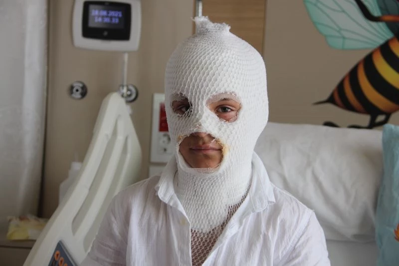 Camide çıkan yangını söndürmeye çalışırken kendisi yandı
