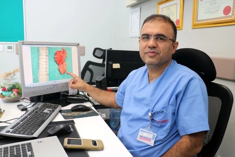 Nefes almakta güçlük çekiyordu burnundan 10 santimetre tümör alındı
