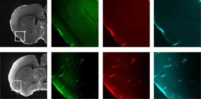 Türk cerrahın Alzheimer’ın şifresini çözecek çalışması saygın tıp dergisinin kapağında
