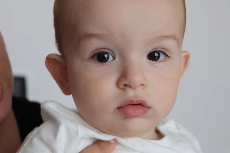 5 binde 1 görülen hastalığa yakalanan bebek erken müdahale ile iyileşti
