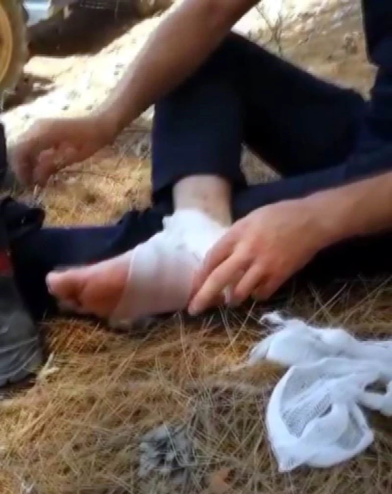 Yaralanan itfaiye eri kendini tedavi ettikten sonra alevlere müdahaleye devam etti
