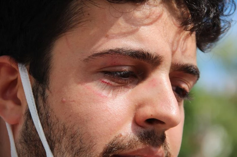 Sokakta köpeklerini gezdiren üniversite öğrencisine saldırı
