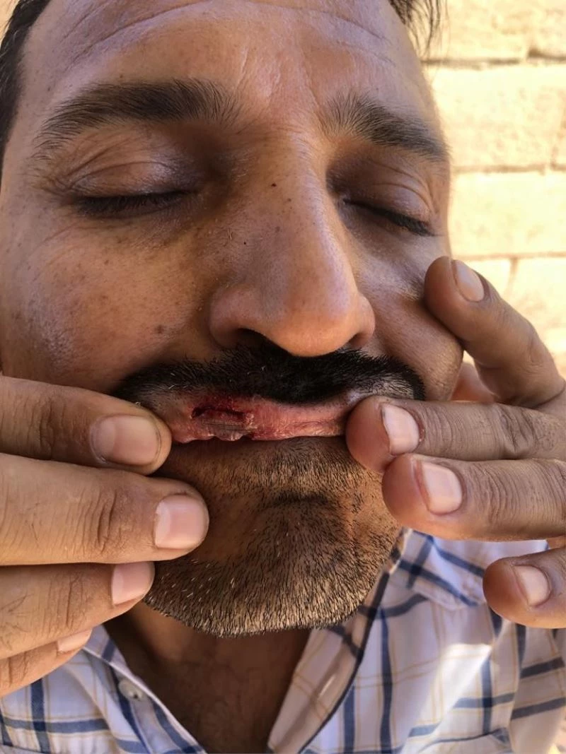 TVHB Merkez Konseyi Başkanı Eroğlu’ndan ‘Yıpranma Payı’ çağrısı
