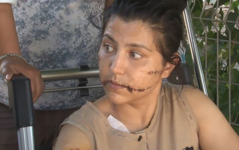 Eşinin banyoya kilitleyip 100 yerinden bıçakladığı kadın o anları anlattı
