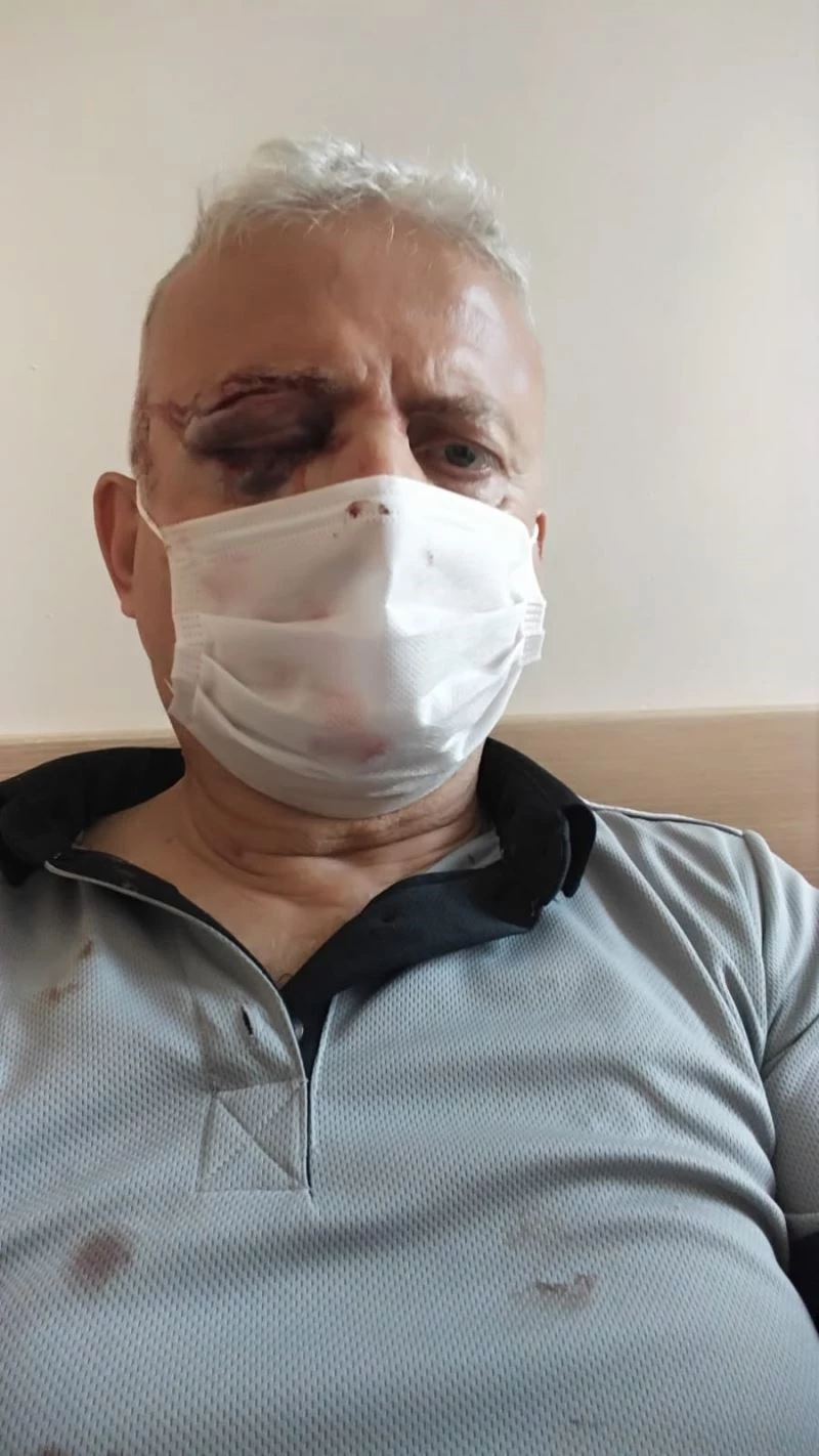 MASKE İÇİN UYARDIĞI KİŞİ TARAFINDAN DARP EDİLEN GÜVENLİKÇİ GÖRMÜYOR