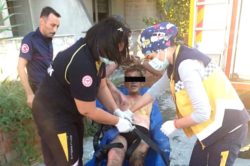 Balıkesir’de inşaatta çöpler yandı, söndürmeye çalışan kişi de yandı
