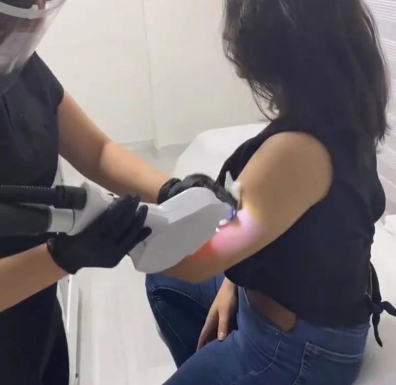 Lazer epilasyon ile istenmeyen tüylere kalıcı çözüm
