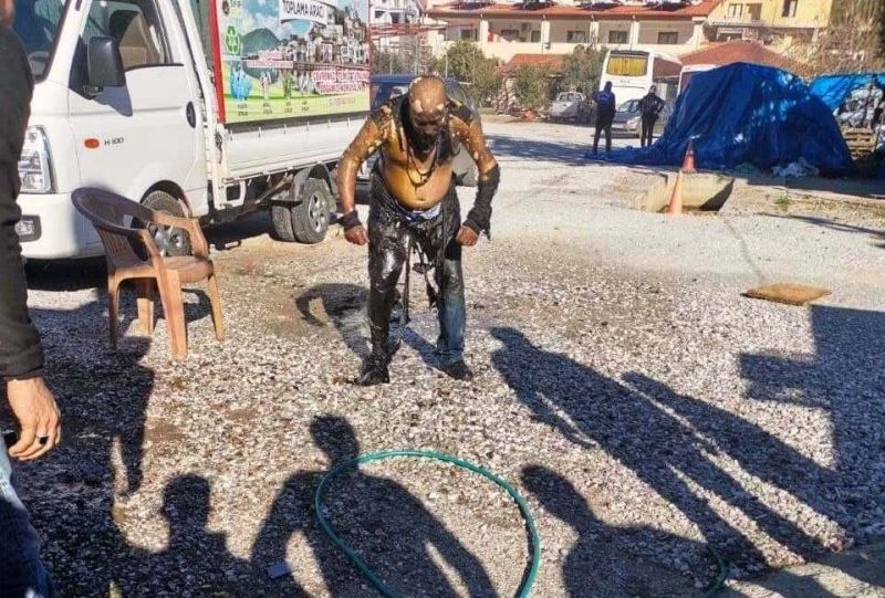 Her yeri yandı, hiçbir şey olmamış gibi derdini anlatmaya çalıştı
