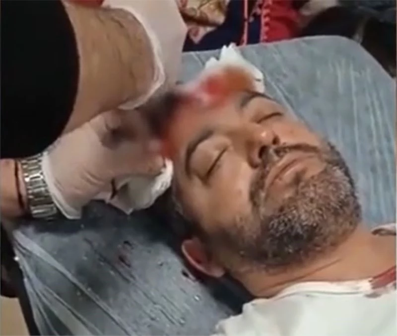 Avukata beyzbol sopalı saldırıda bulunan sanık için istenen ceza belli oldu
