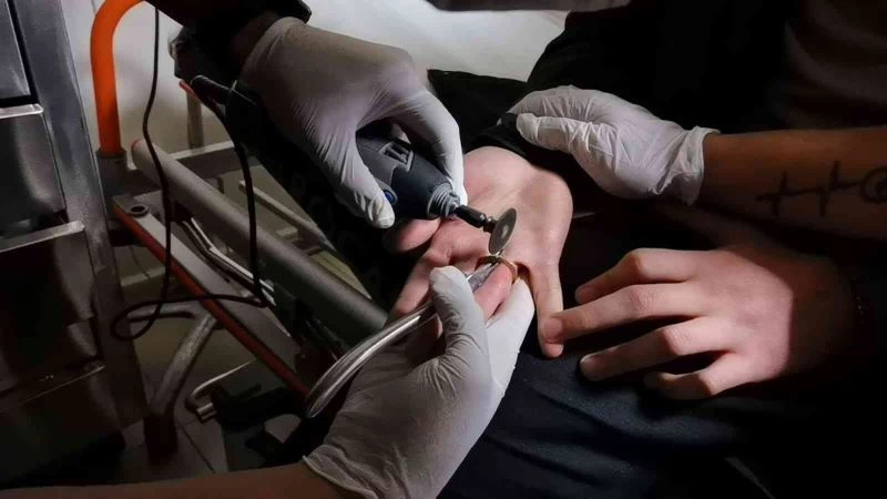 Bursa’da ilginç olay: Parmağına 1 TL sıkıştı
