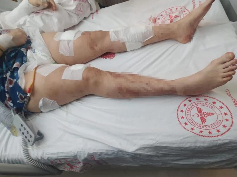 İstanbul’da koca dehşeti: Kucağına çocuğunu alıp eşine 12 el ateş etti
