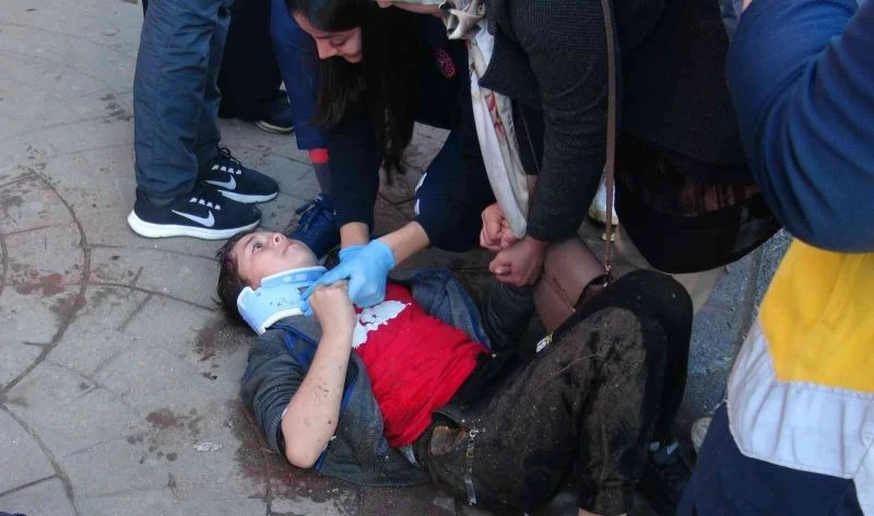 Motosikletin çarptığı çocuk 