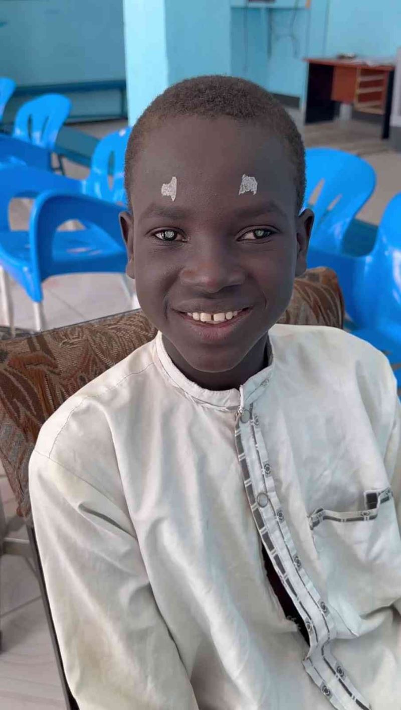 Katarakt hastası Afrikalı çocuk Türk hayırseverlerin bağışlarıyla sağlığına kavuştu
