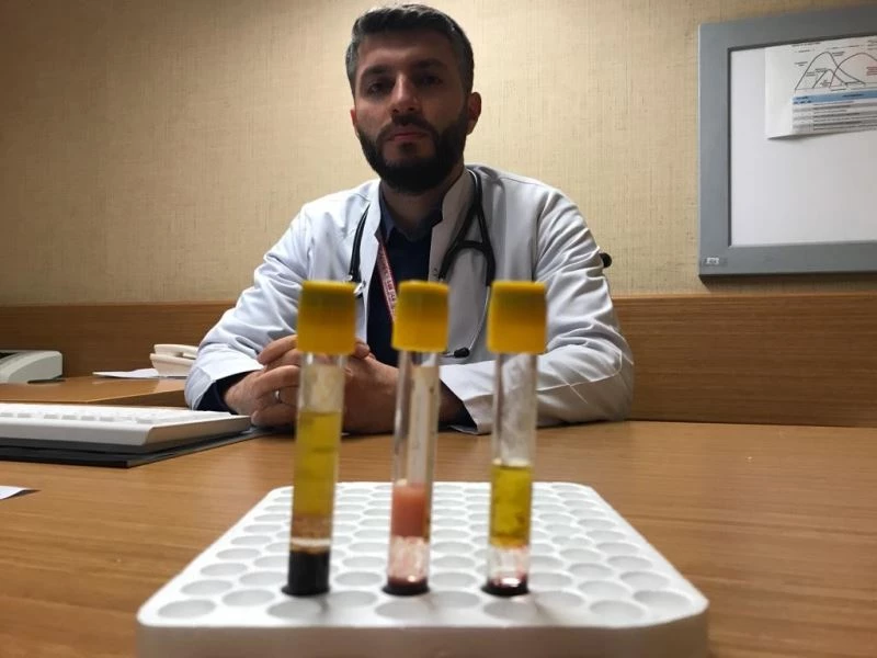 Kolesterolün önemi kanda ortaya çıktı: Düşükte kan berrak, yüksekte bulanık ve katı
