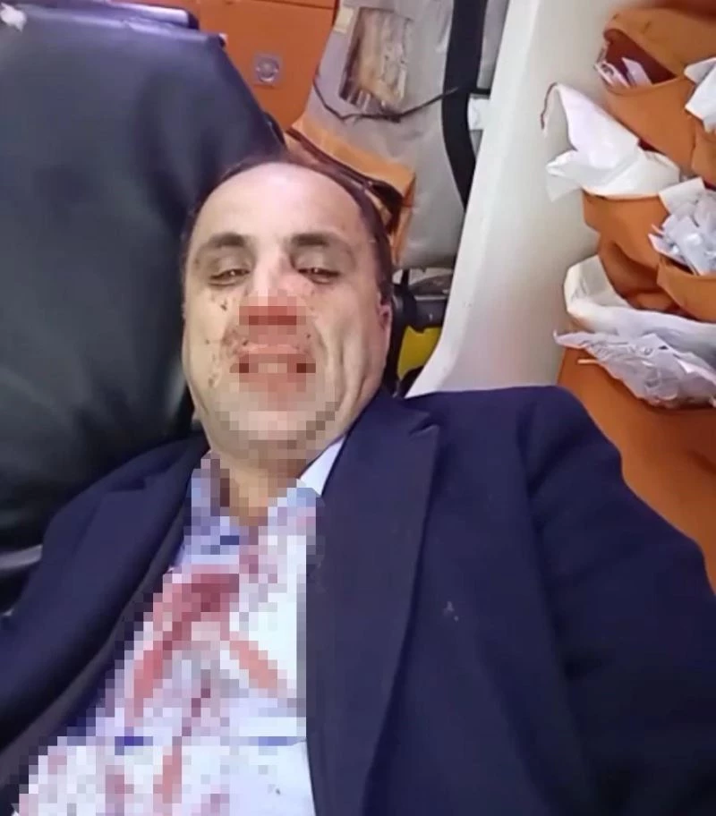 Diyarbakır Berberler, Kuaförler ve Güzellik Uzmanları Esnaf Odası başkanlık seçiminde kavga
