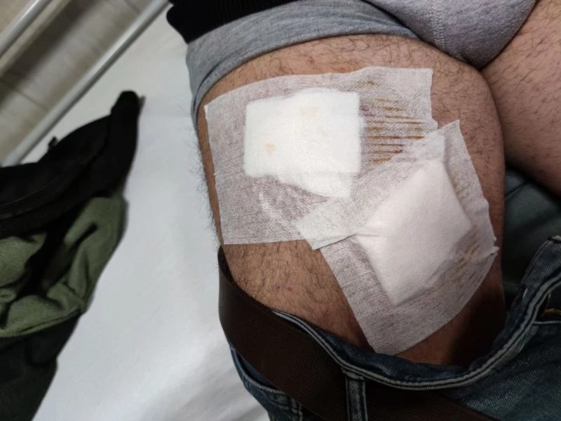 Tarladaki çiftçi köpeklerin saldırısına uğradı
