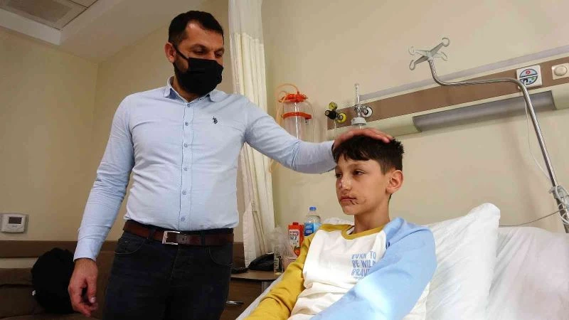 Minik Asiye gibi yüzünden yaralanan Berat’tan sevindiren haber
