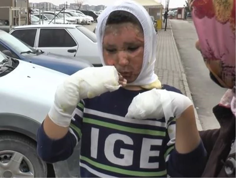 4 çocuğun mazot dolu tenekeyle oyunu faciayla bitti
