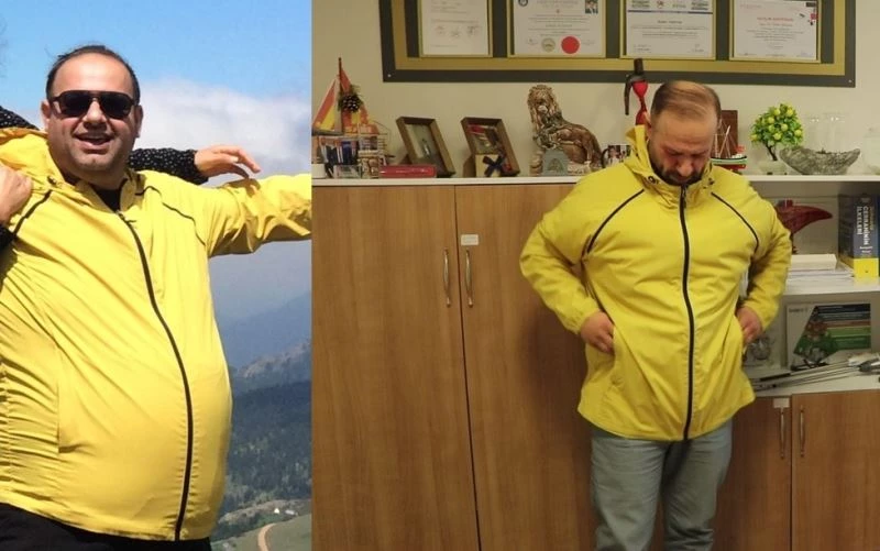 1,5 yılda 55 kilo verdi, 140 kilodan 85 kiloya düştü
