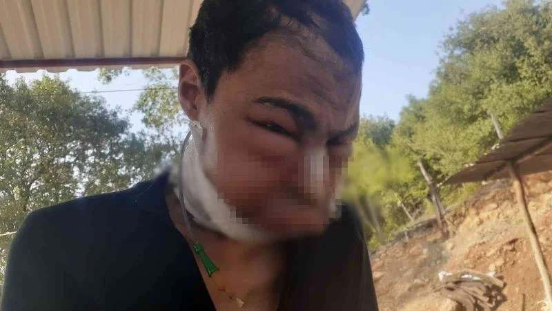 Yakalandığı hastalık kabusu olmuştu, hayatını kaybetti
