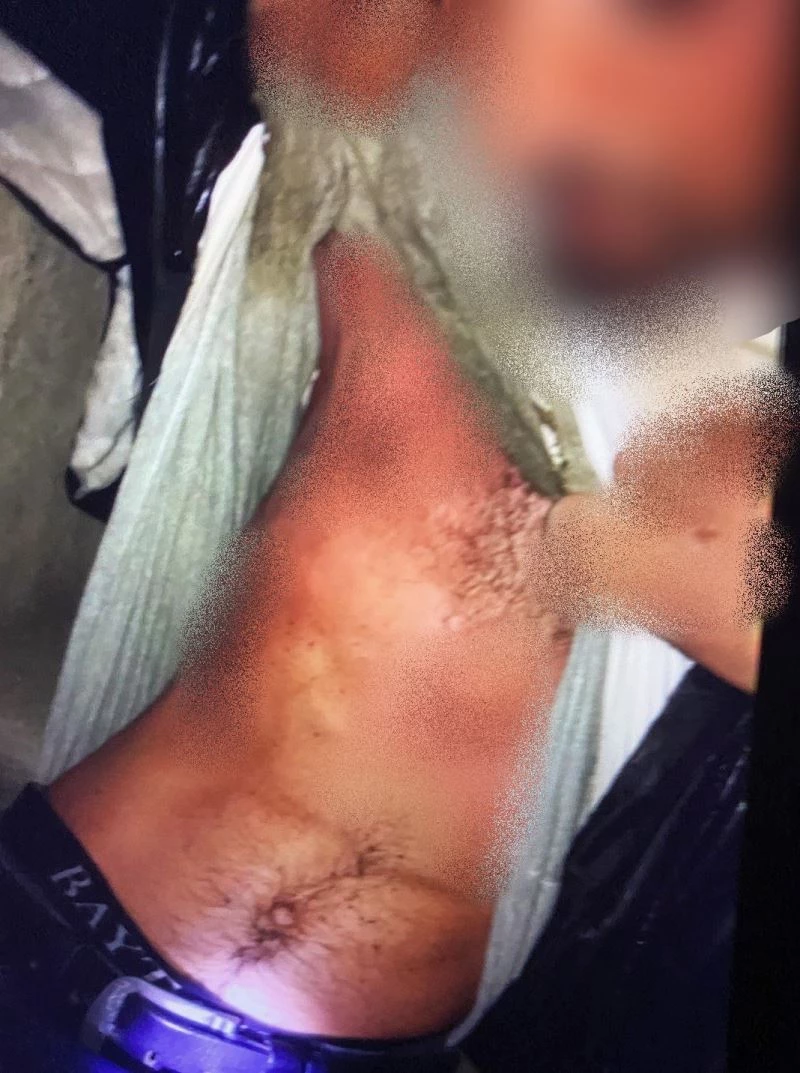 Hırsızlık için girdiği elektrik trafosunda akıma kapılan şahıs ağır yaralandı
