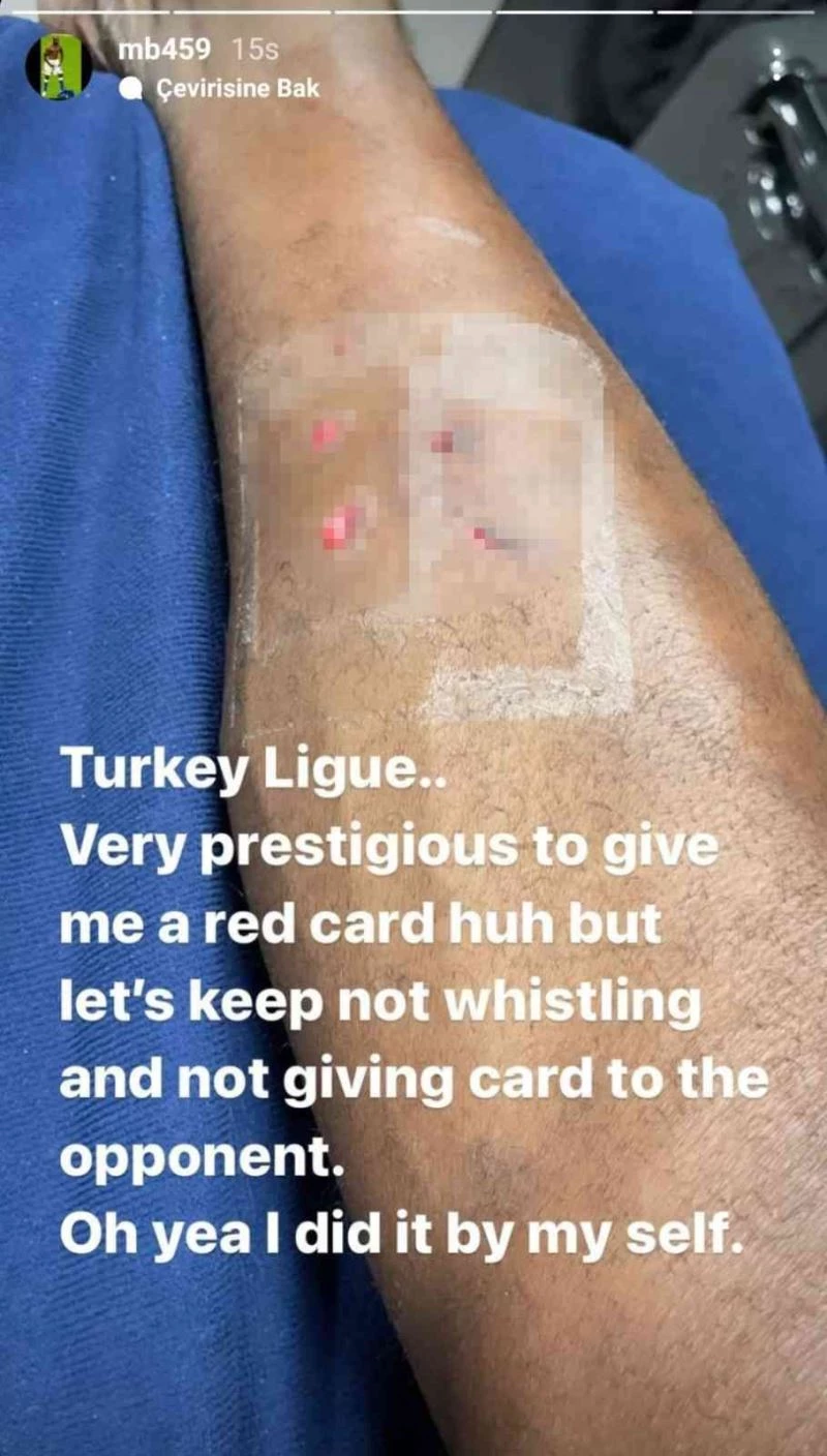 Balotelli’den kırmızı kart tepkisi
