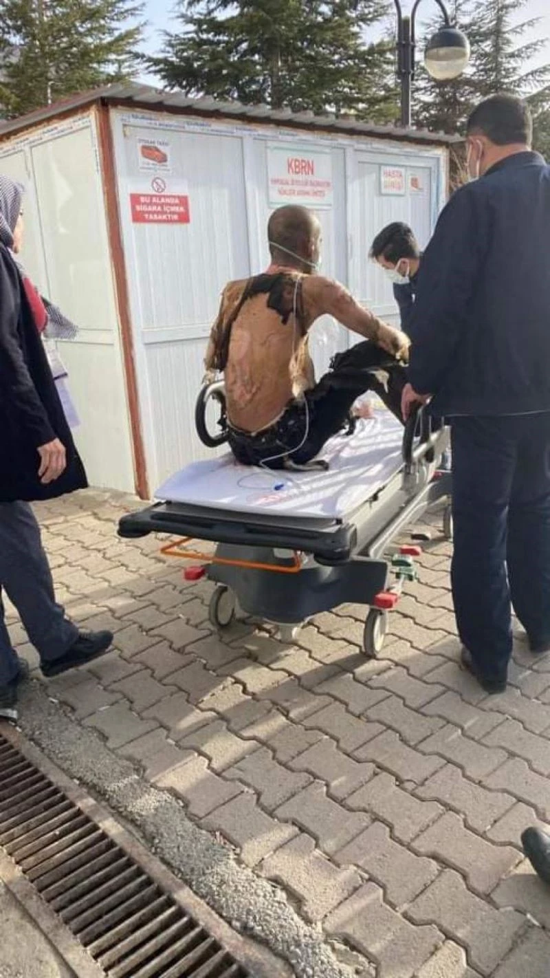 Üzerine benzin döküp yaktı, o anlar saniye saniye kaydedildi
