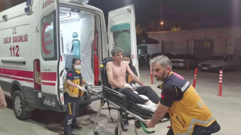 Üzerine asit dökülen işçi ağır yaralandı
