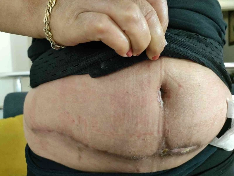 Güzelleşmeye gitti, estetik mağduru oldu
