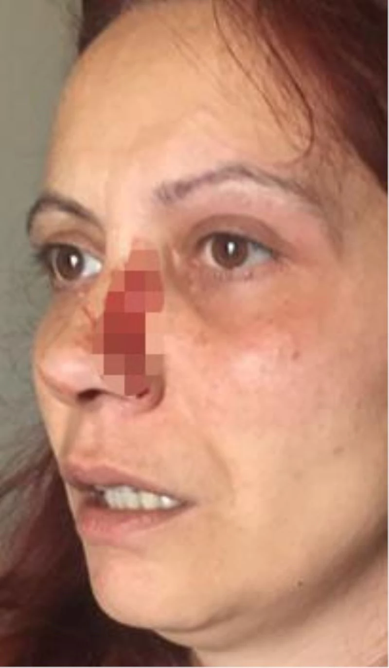 Büyükçekmece’de sitede kadına darp iddiası
