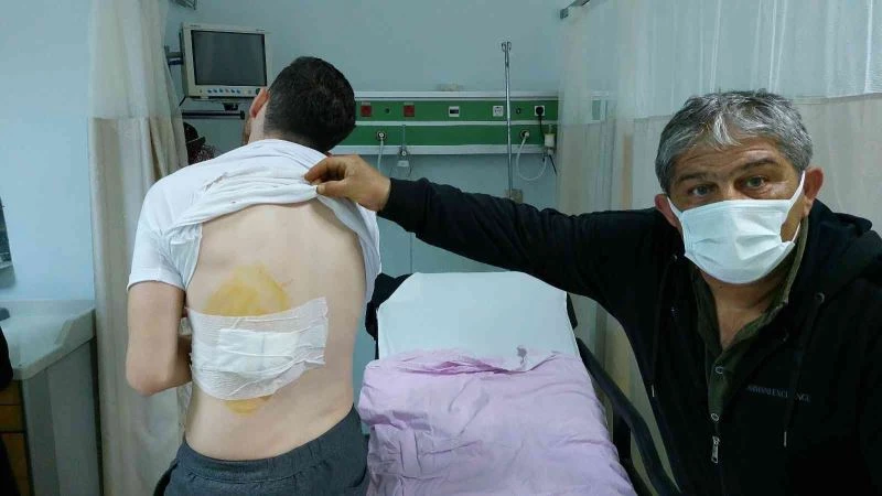 Ankara’dan bayram için geldiği Samsun’da sokak köpeğinin saldırısına uğradı
