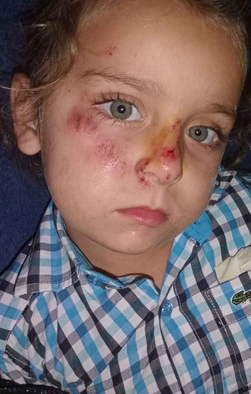 Sokak köpeği, sırtından ısırdığı çocuğu yüz üstü sürükledi
