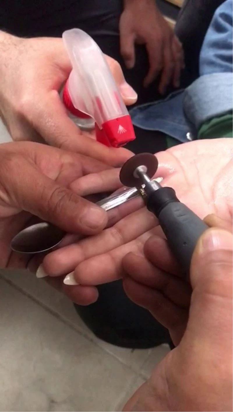 Parmaktan çıkmayan çelik yüzüğü itfaiye çıkarttı
