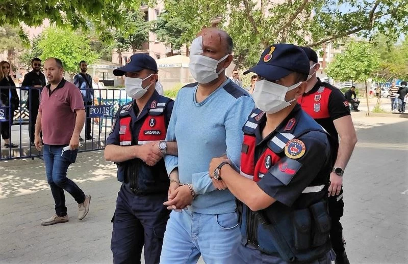 Sevgilisinin üzerine asit döktüğü genç kadın yaşama 38 gün tutunabildi
