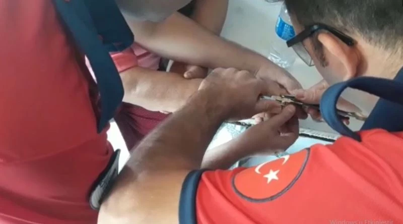 Denedikleri yüzüklerden kurtulamayan kadınların imdadına itfaiye yetişti
