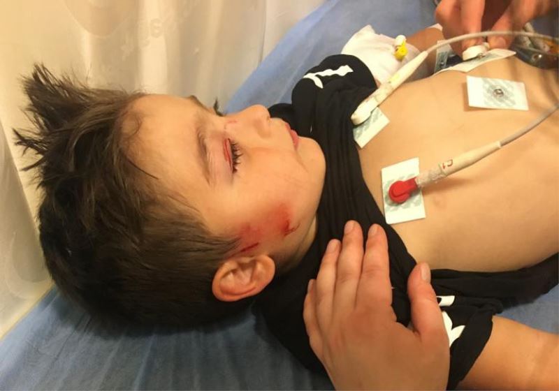 Köpeklerin saldırdığı 3 yaşındaki çocuğun yüzü parçalandı
