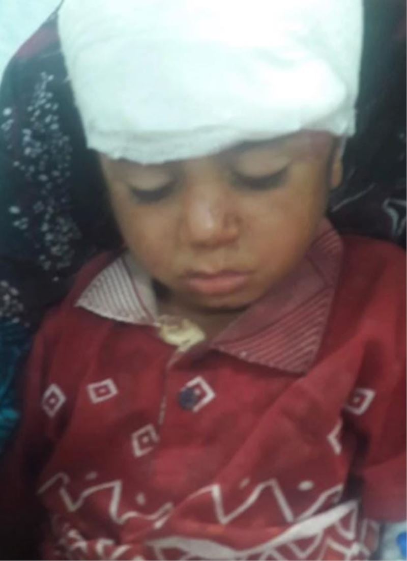 Şanlıurfa’da atın teptiği çocuk yaralandı
