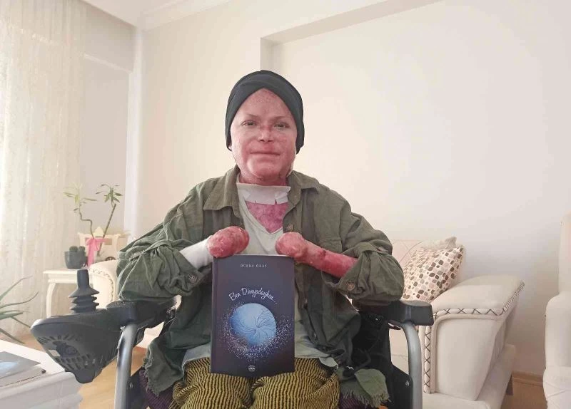 Kelebek hastası Büşra günlüklerini kitap haline getirdi
