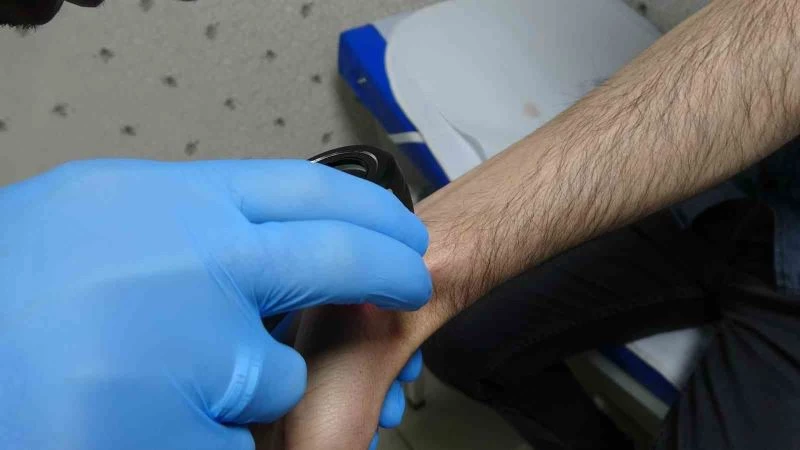 Uzman doktor uyardı: 