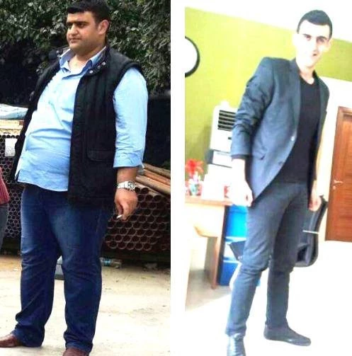 Obeziteyi nasıl tanımlayabiliriz?